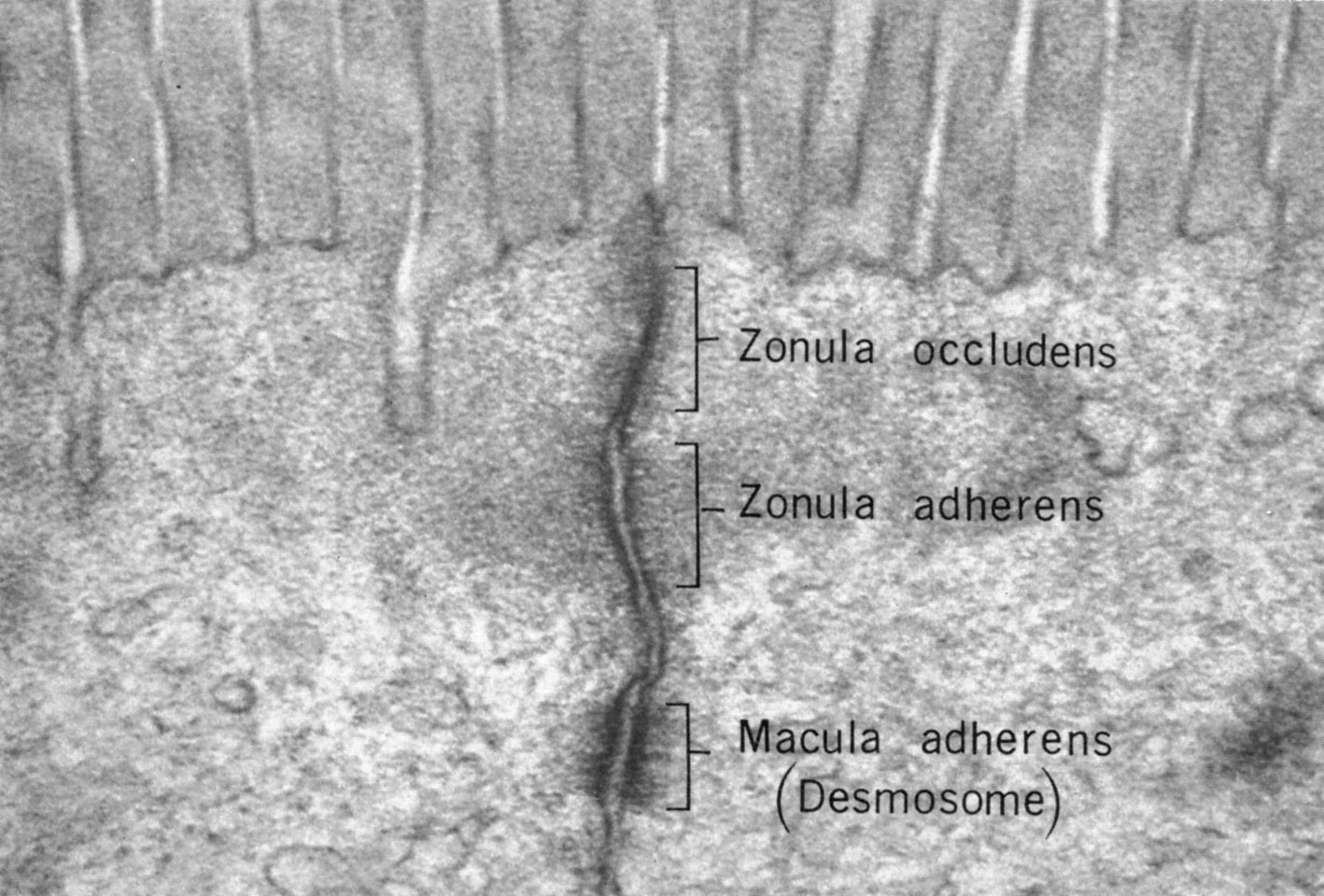 Junctional complex