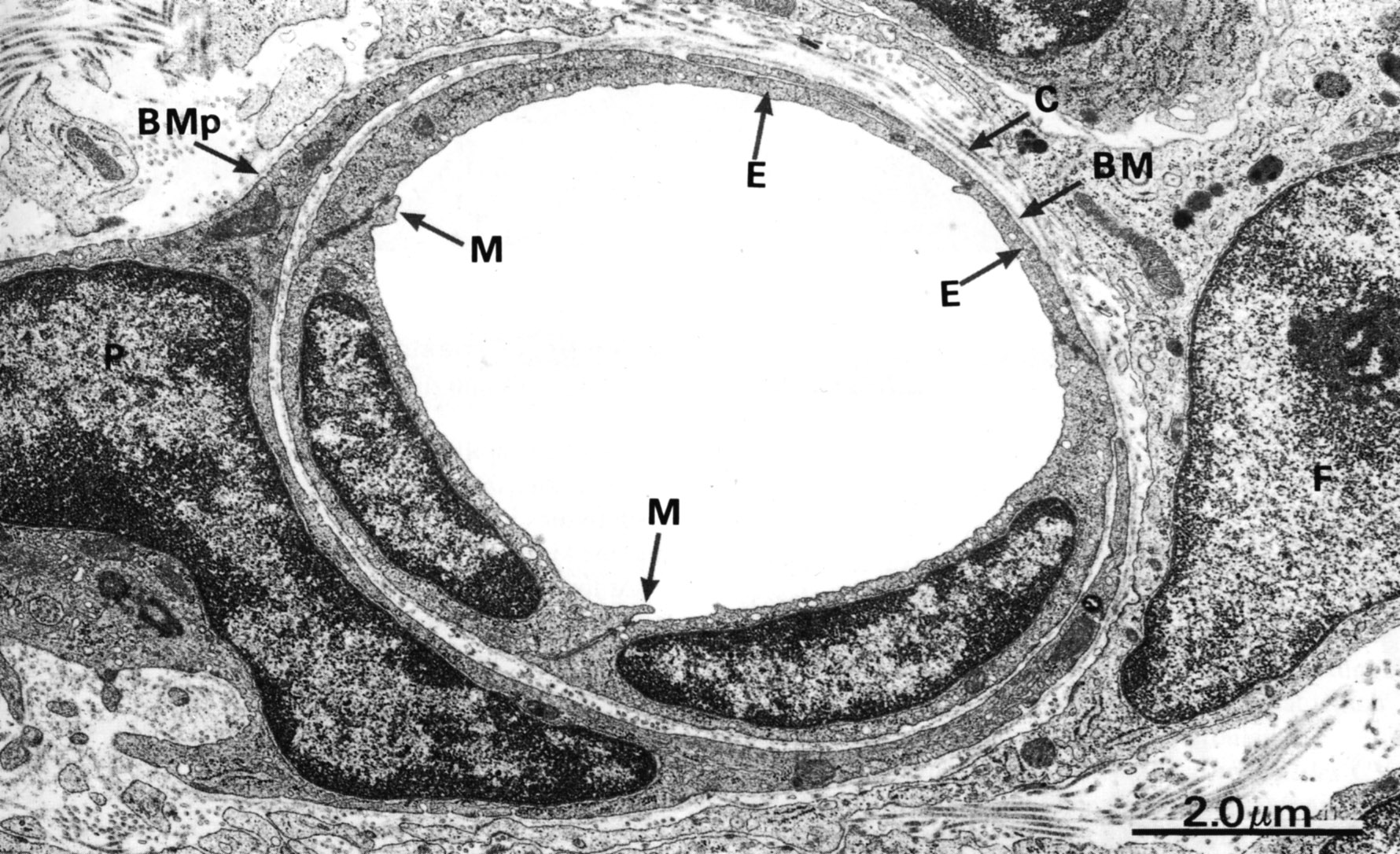 Simple squamous epithelium