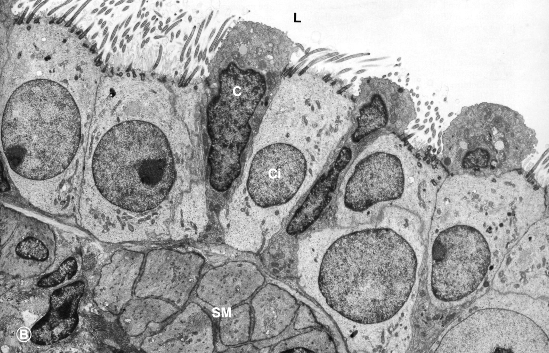 Terminal bronchiole