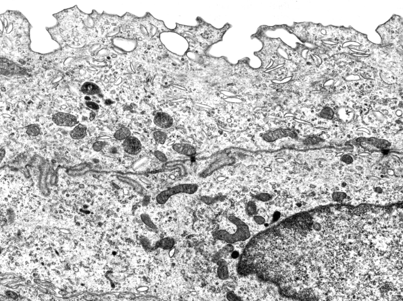 Transitional epithelium (urothelium)