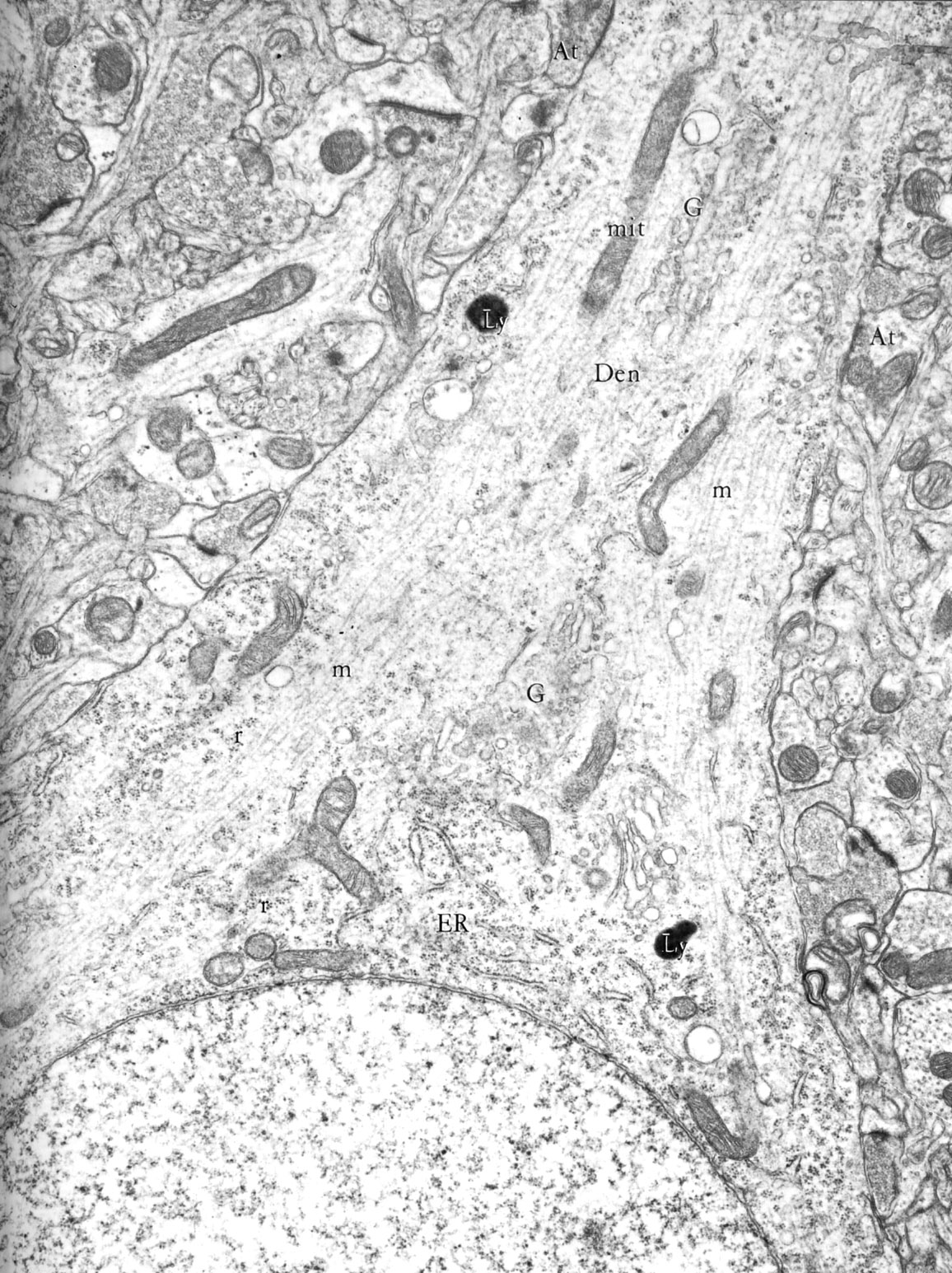 Apical pole of pyramidal neuron