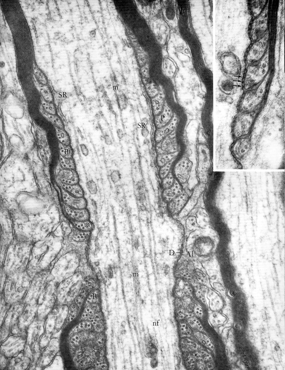 Node of Ranvier in CNS