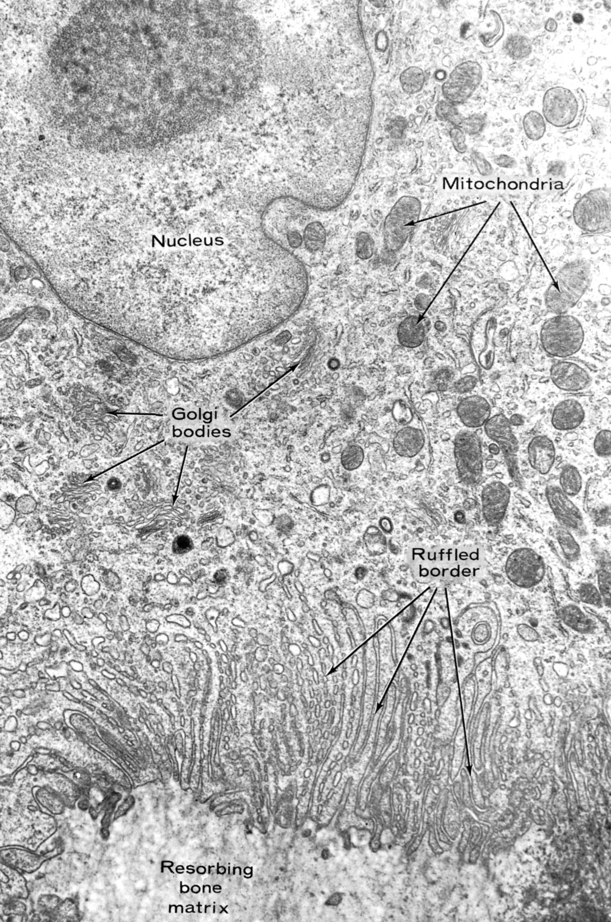 Osteoclast