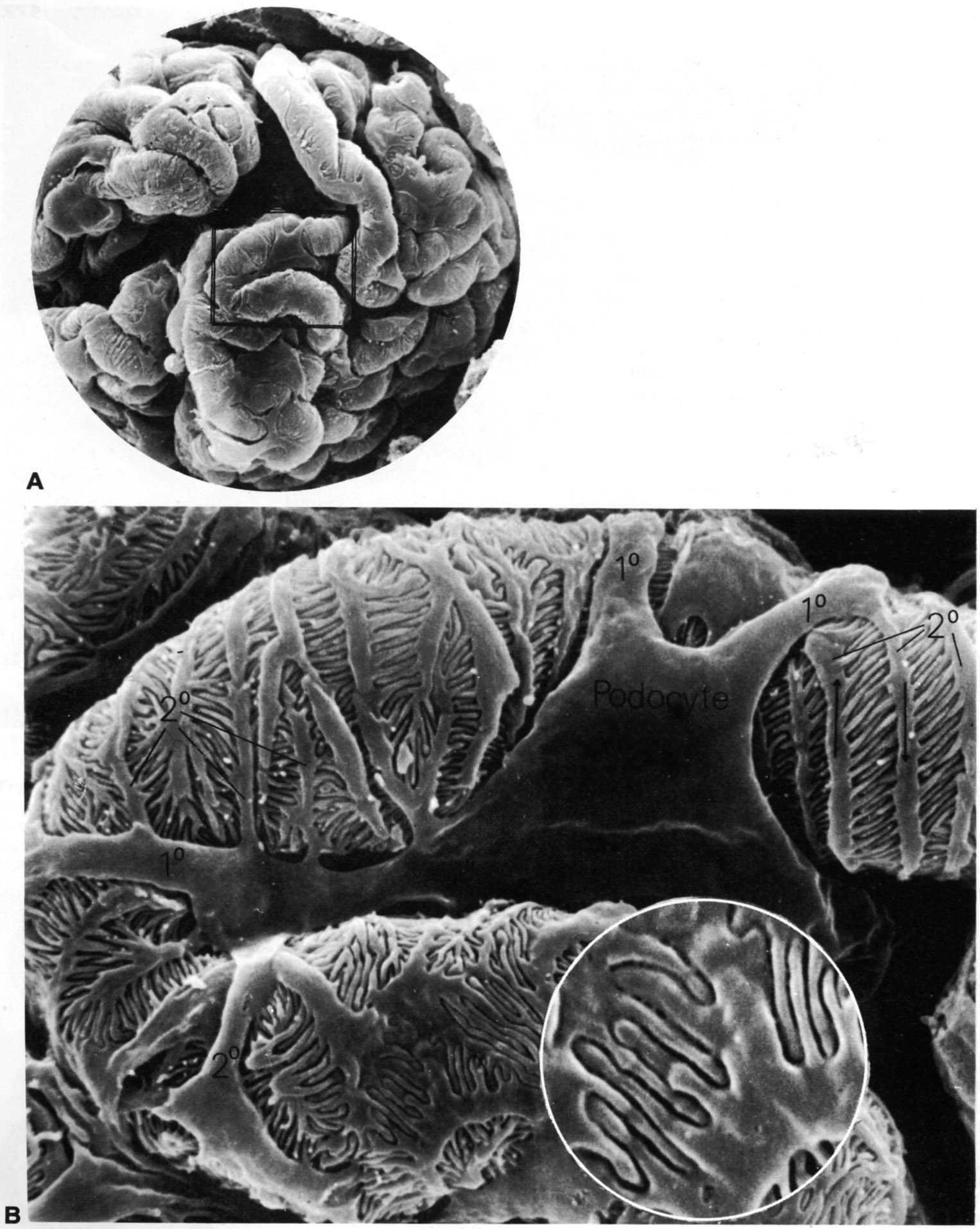 Glomerular loops (SEM)