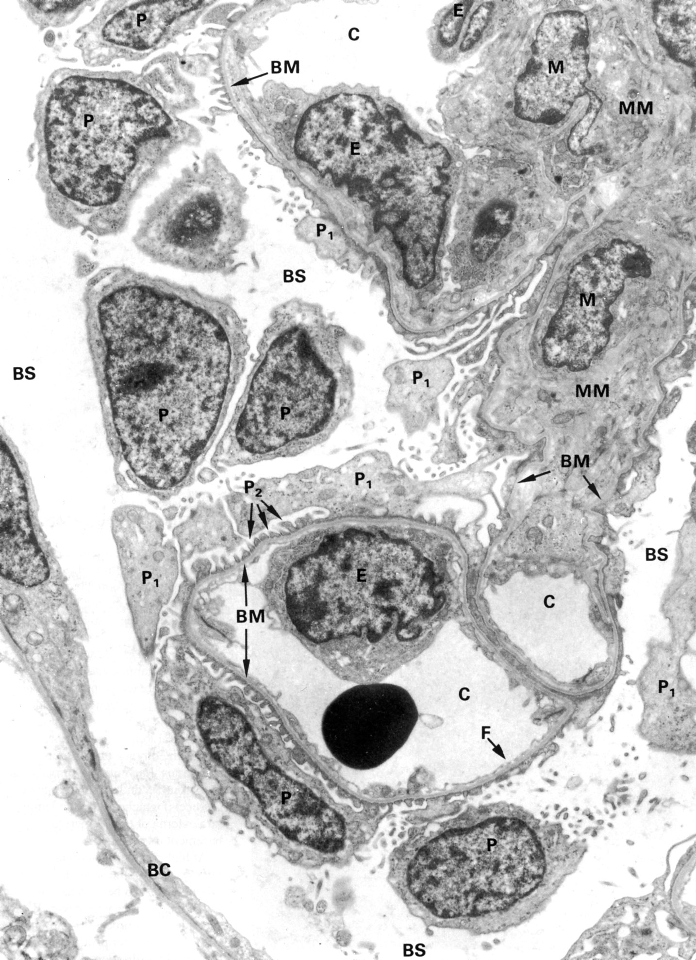 Bowmans capsule and glomerulus