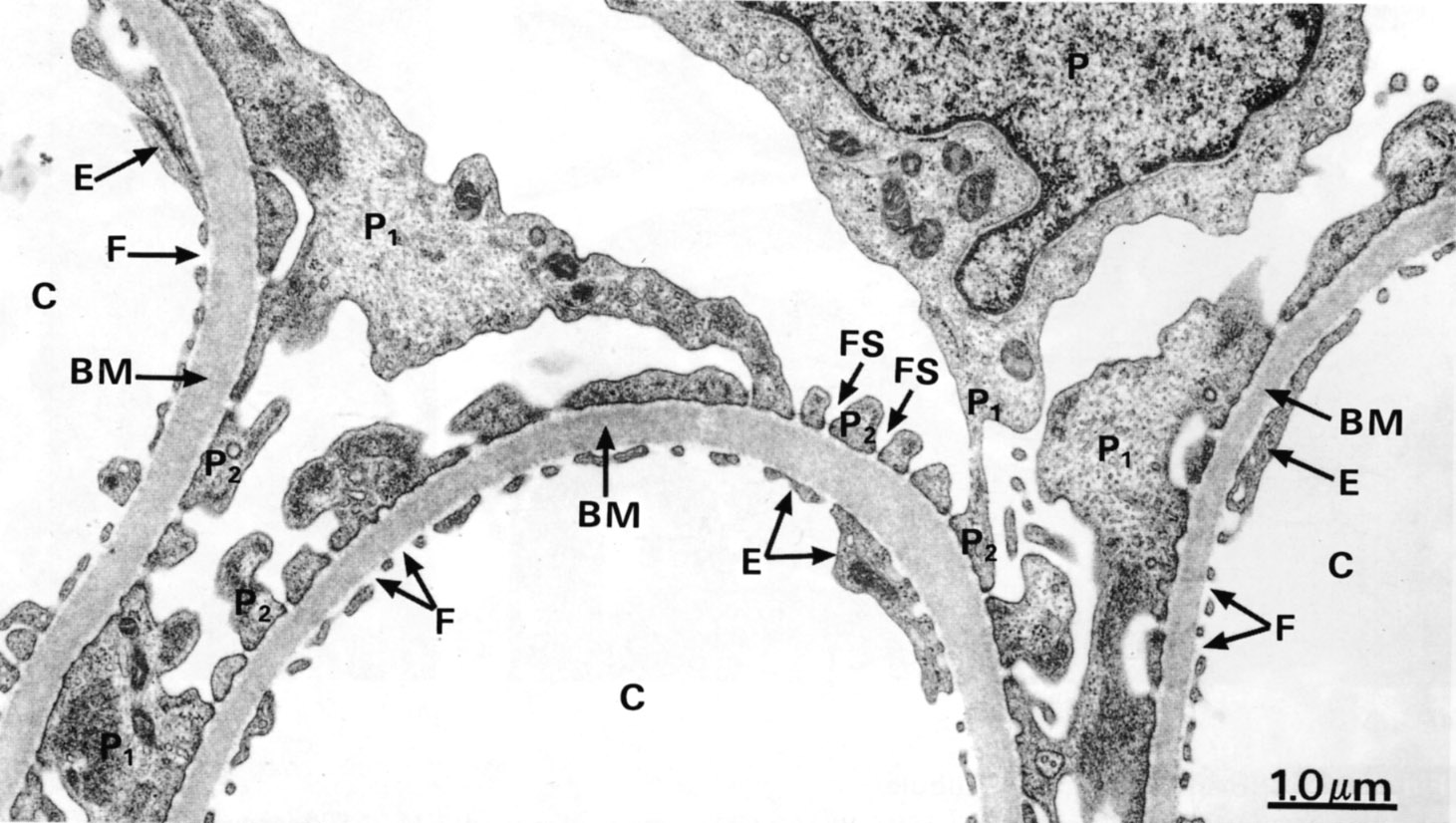 Glomerular basement membrane