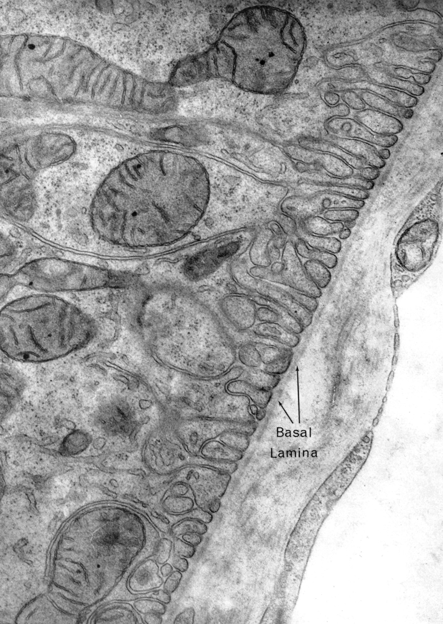 Basal lamina of proximal tubule