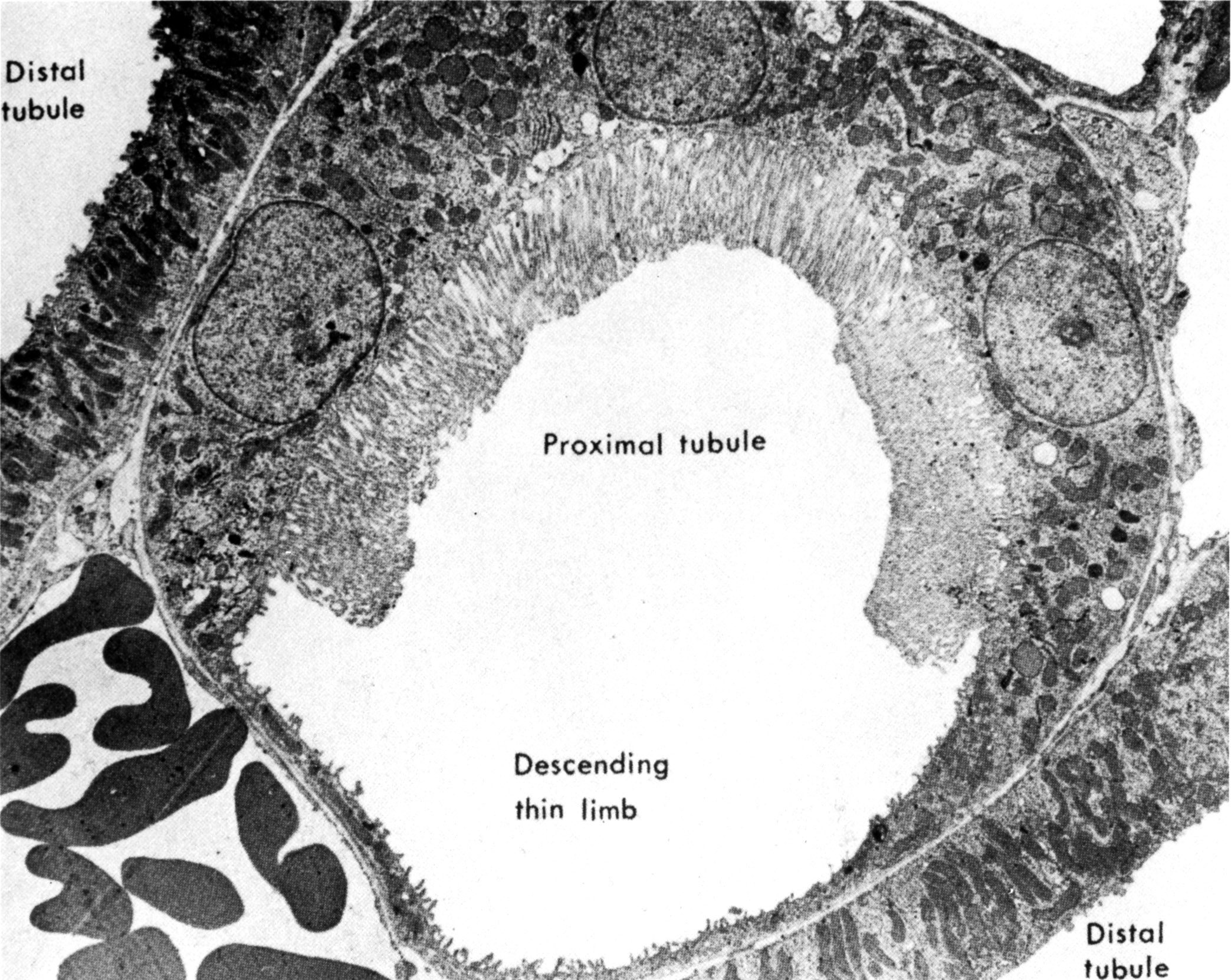 Kidney tubules