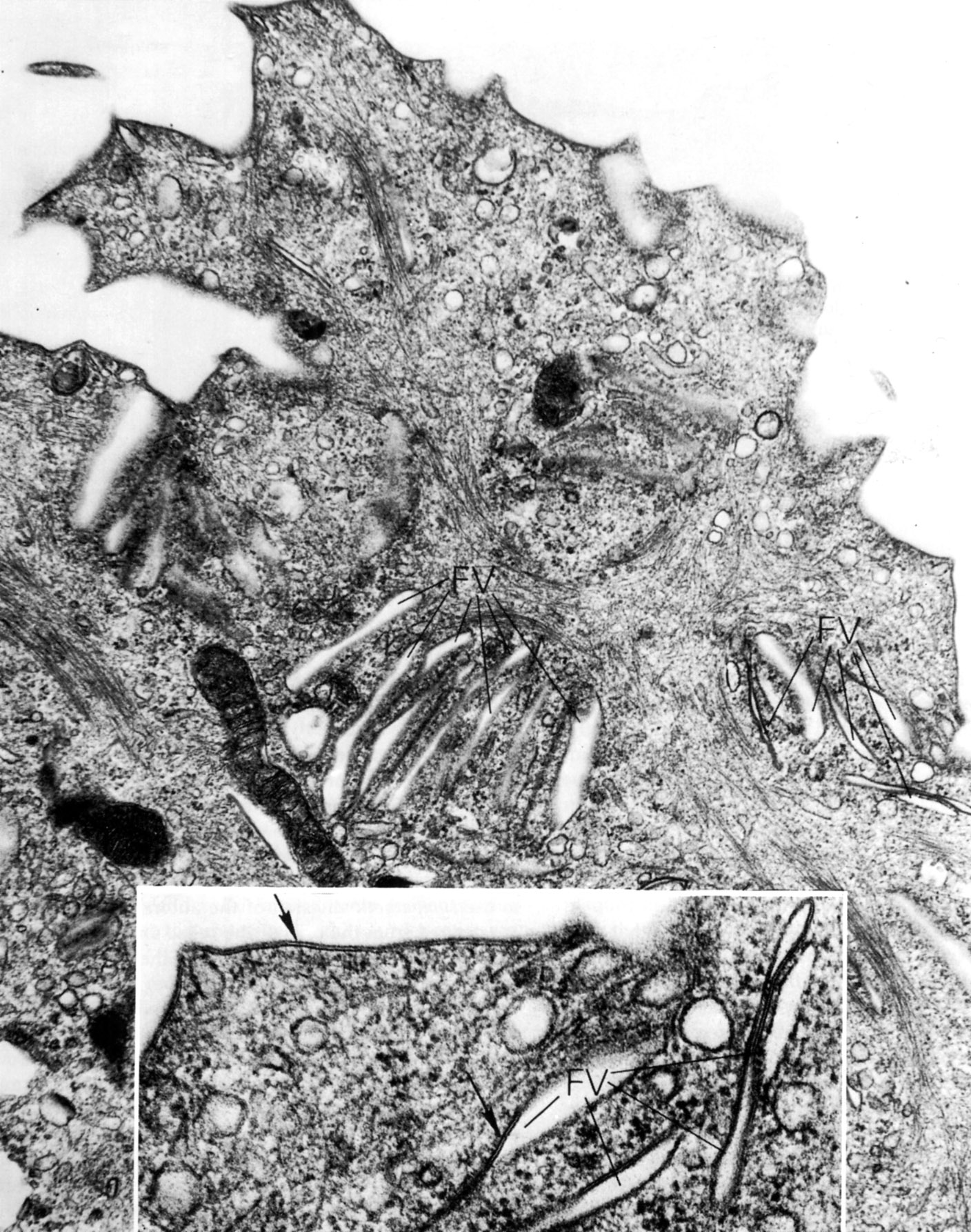 Transitional epithelium (urothelium)