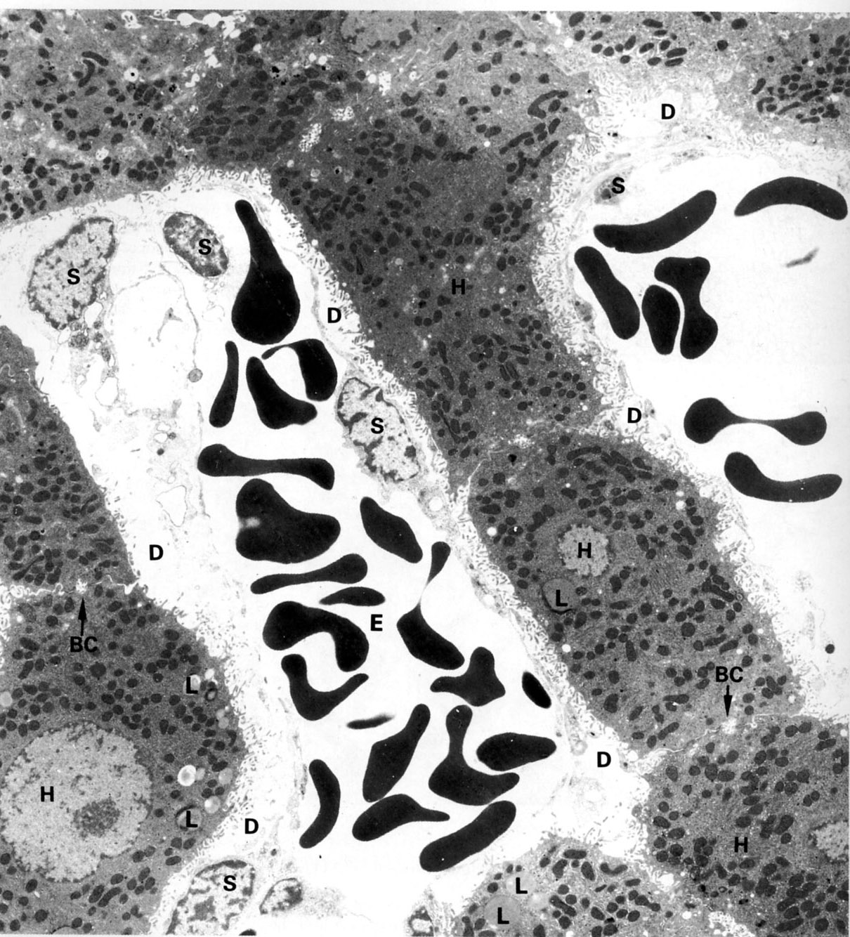 Plates of hepatocytes