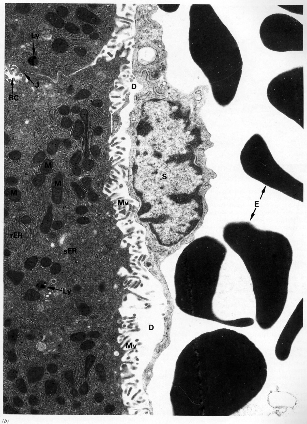 Plates of hepatocytes