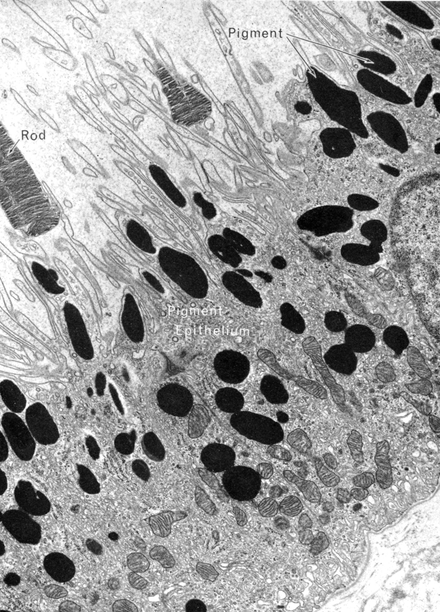 Retinal pigment epithelium (human)