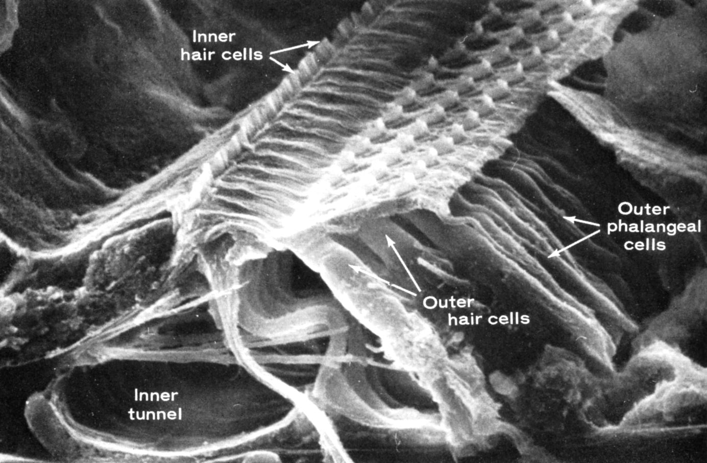 Retinal pigment epithelium (human)