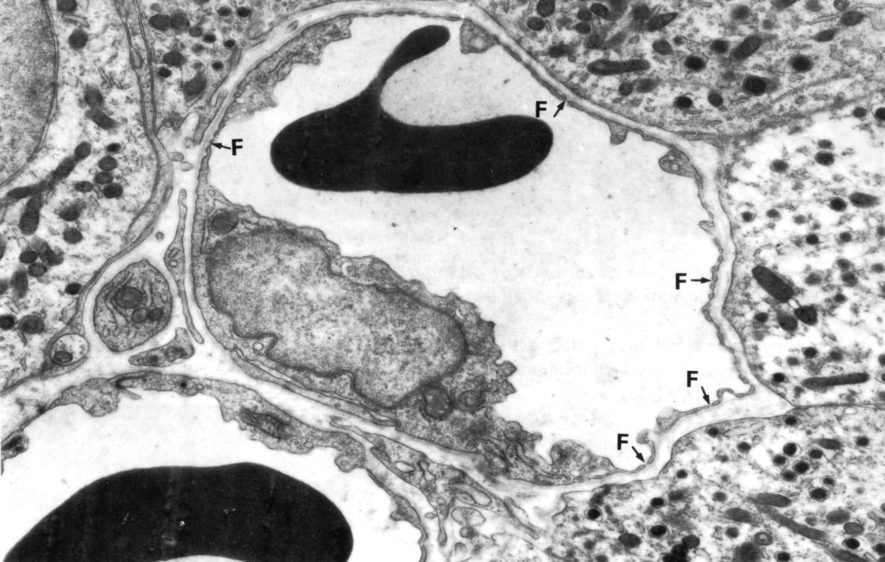 Fenestrated capillary