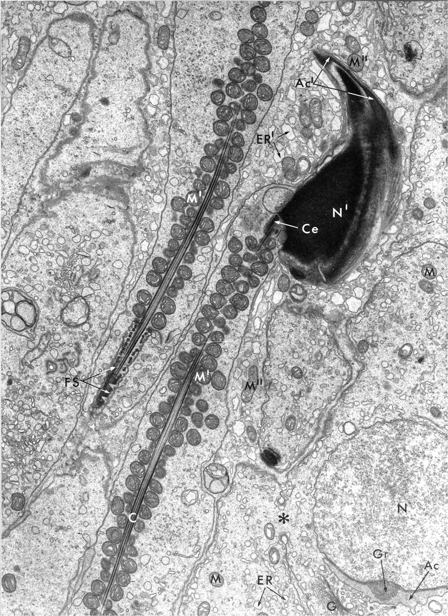 Spermiogenesis, spermatids