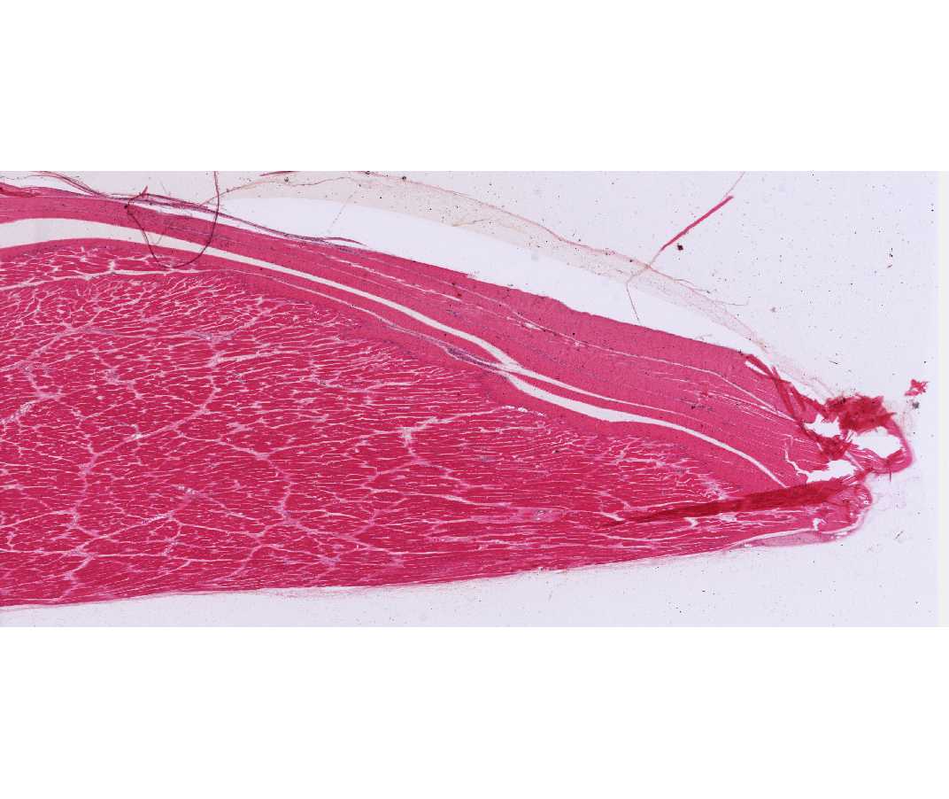 #3 Muscle and tendon junction, Human or Rabbit