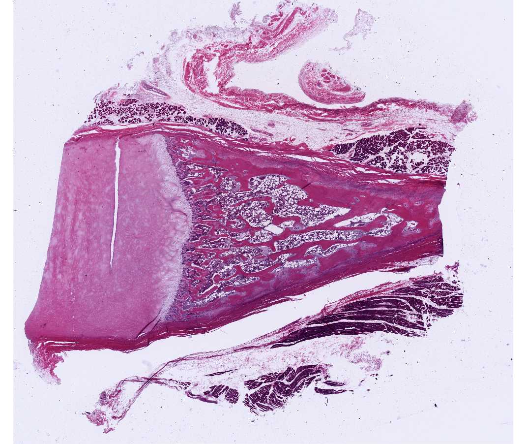 #8 Rib and Cartilage, Human or guinea pig. (H&E) 