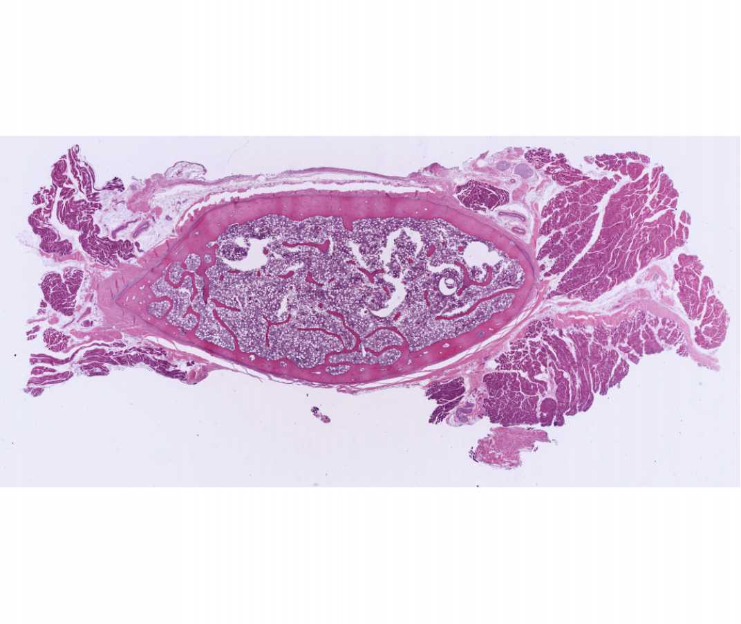 #11 Rib, Cross Section. (H&E).