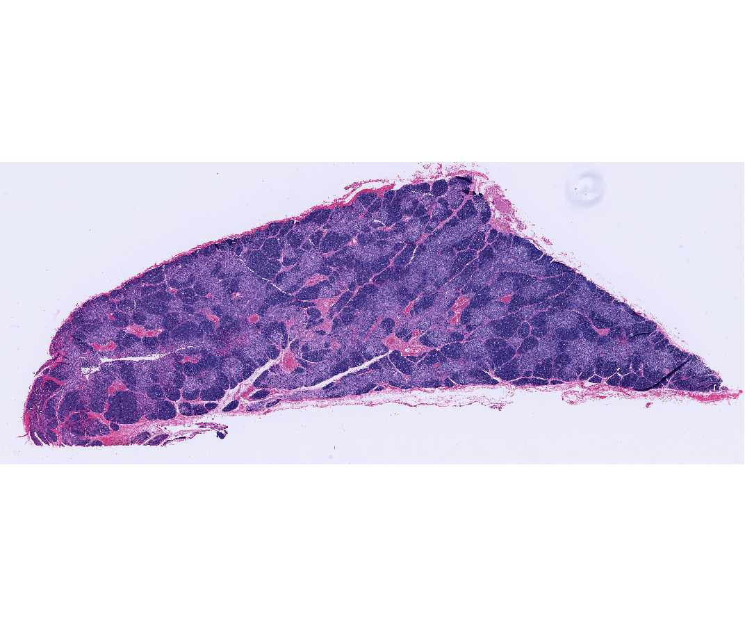 #26 Thymus, 21-month-old child or rabbit