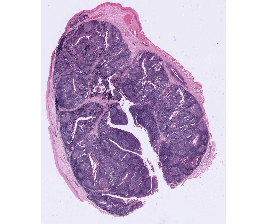 #27 Palatine tonsil, Human. H & E