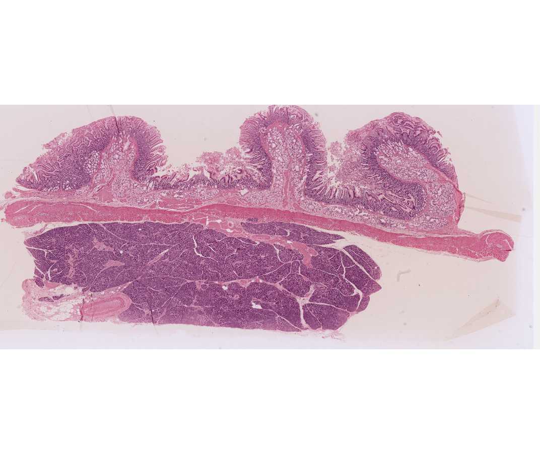 #36 Small intestine, duodenum, Human