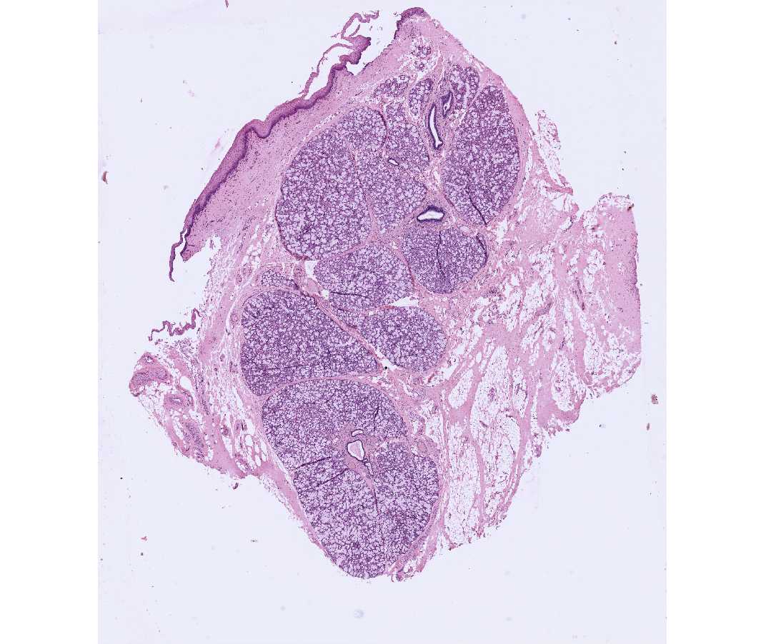 #41 Sublingual Gland, human, H&E