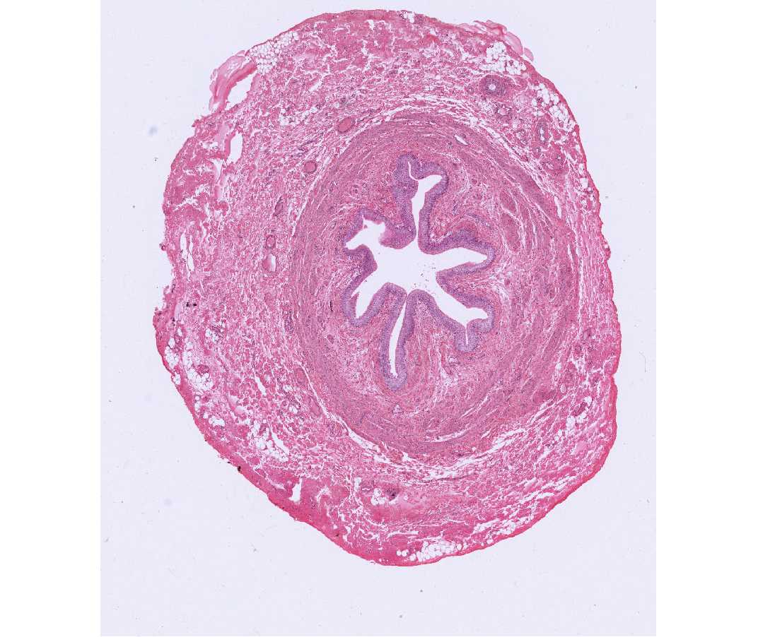 #53 Ureter, Human. H&E or Masson's Trichrome  