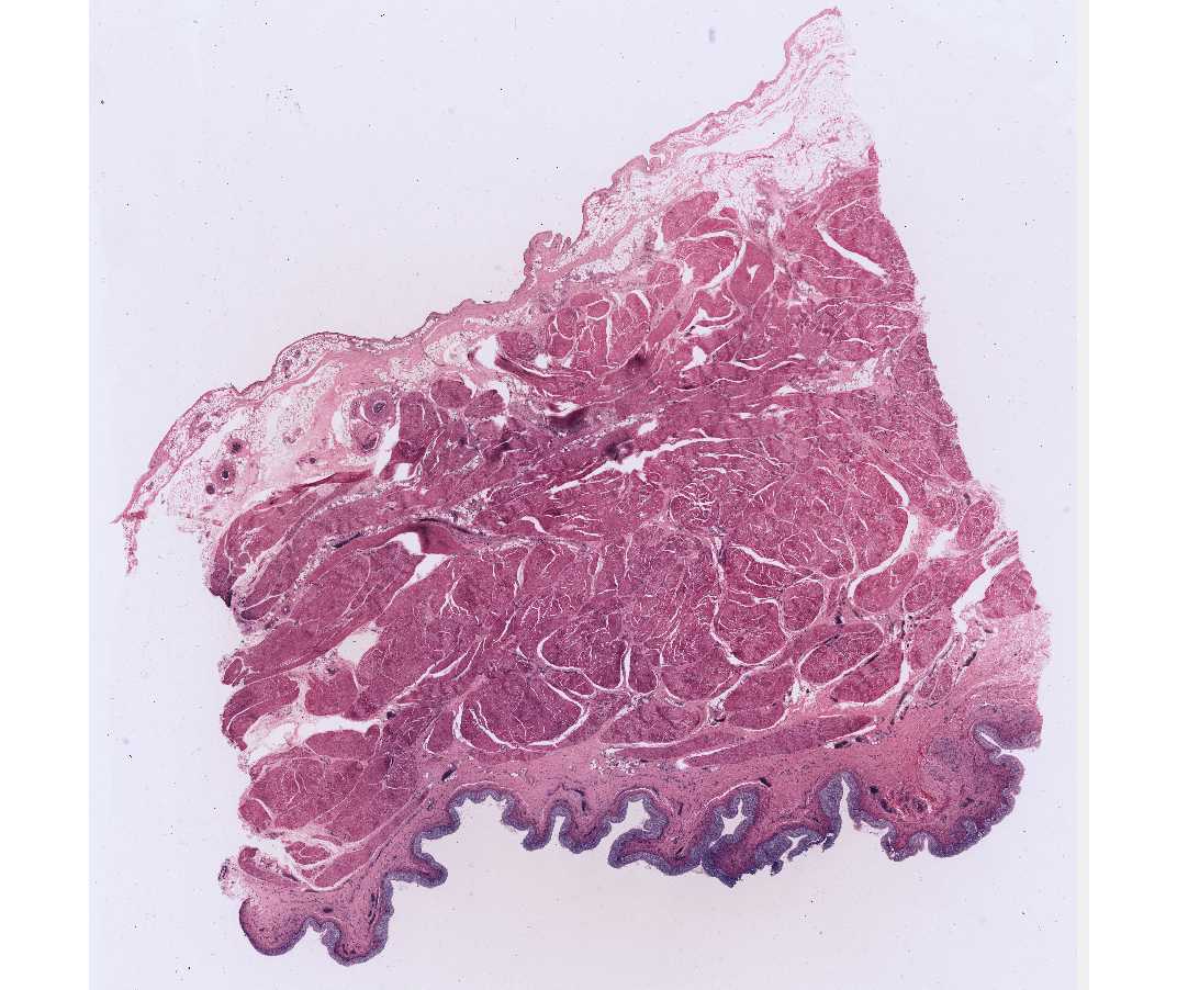 #54 Urinary Bladder, Human, H&E