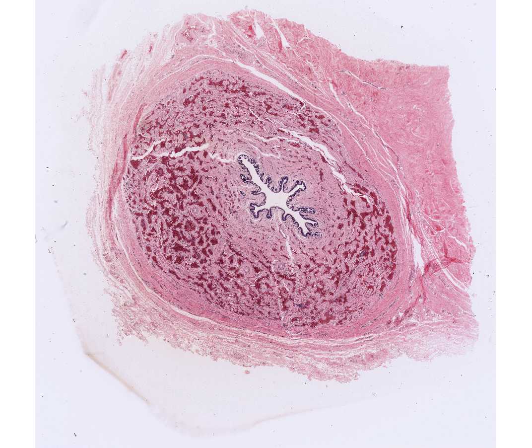 #55 Corpus Spongiosum, Human or Rabbit, H&E