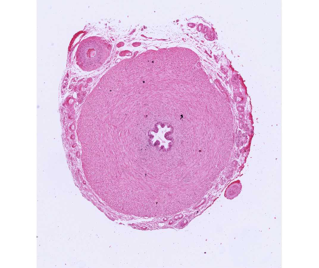 #58 Ductus Deferens, Human, H&E or trichrome (Masson)