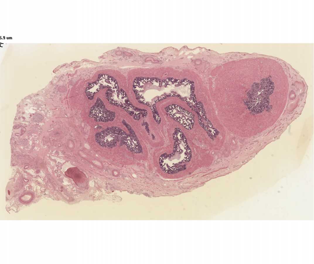 #60 Seminal Vesicle, Human, Age 34, H&E