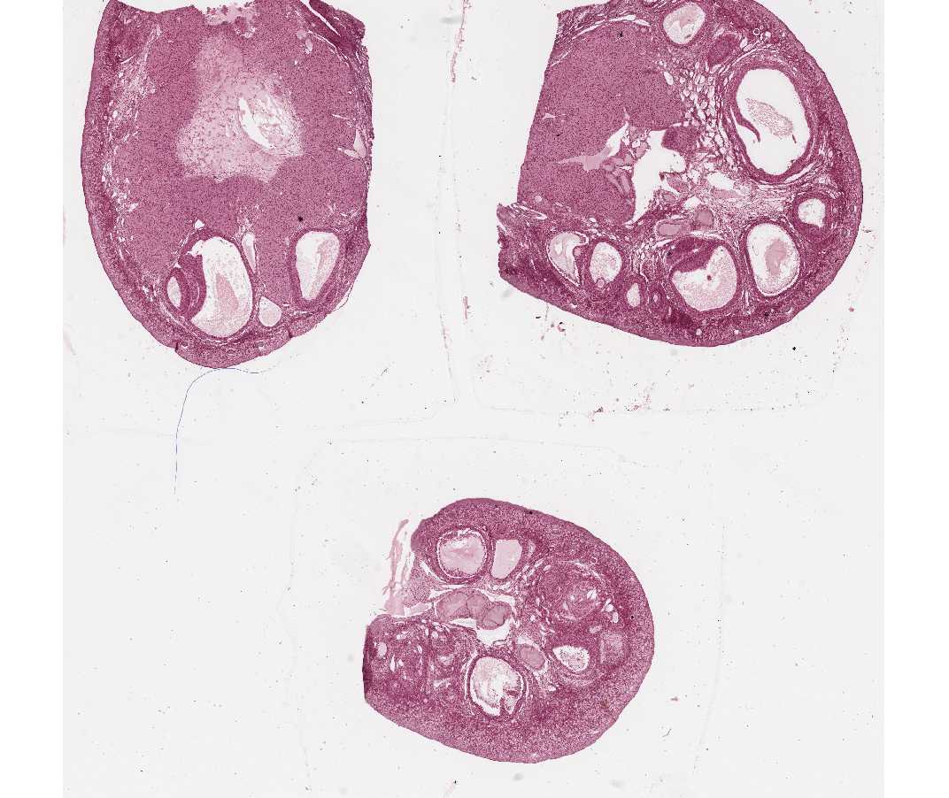 #61 Ovary, Adult Monkey. 