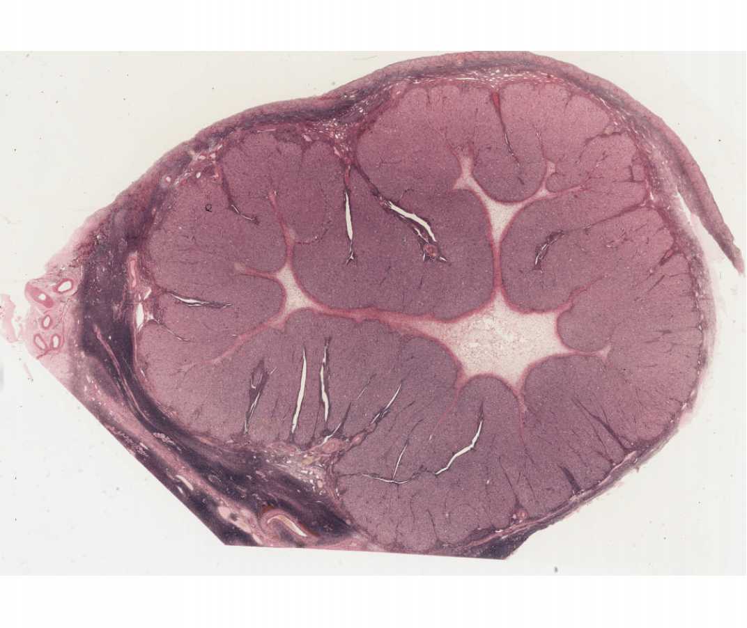 #64 Ovary, Adult Human, Corpus Luteum of Pregnancy