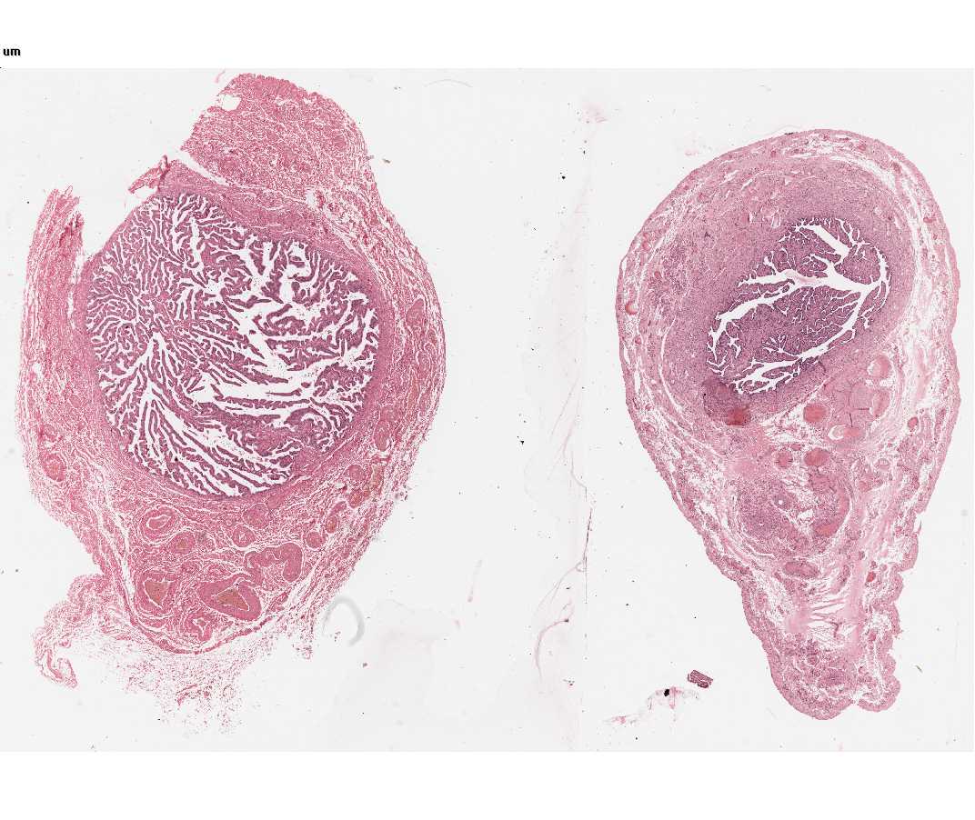 #68 Uterine Tube, Human, H&E 