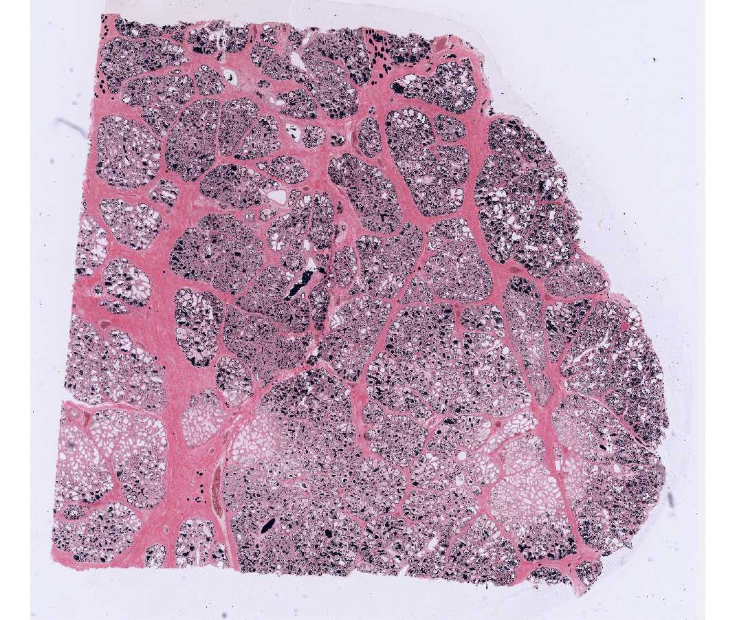 #69 Mammary gland, Lactating, Human (Osmium fixation) 