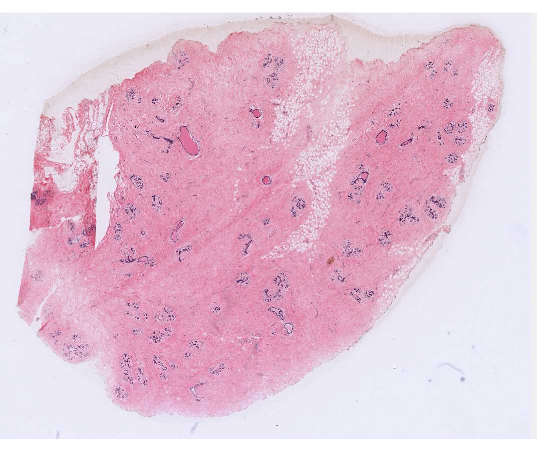 #70 Mammary gland, Post-menopausal, Human (H&E)