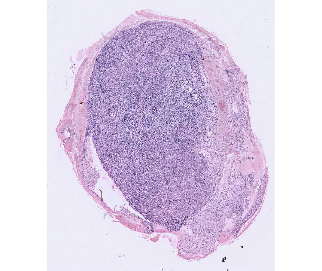 #74 Pituitary, Human. H&E