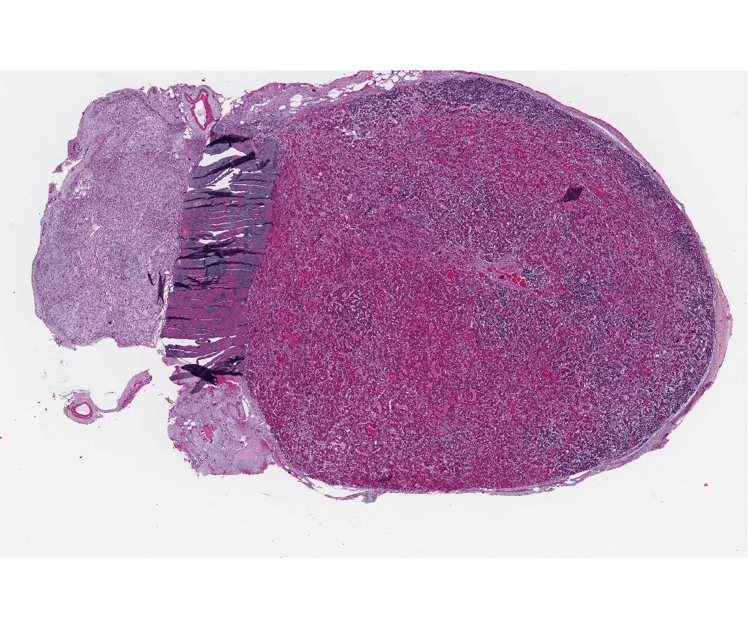 #75 Pituitary, Human (Chrome-hematoxylin and Phloxin) 