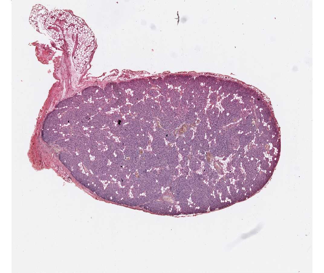 #79 Human Parathyroid