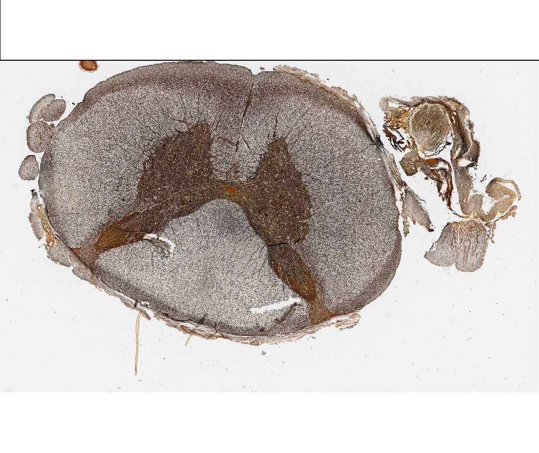 #84 Spinal Cord, Monkey, Cross Section (Cajal's silver)