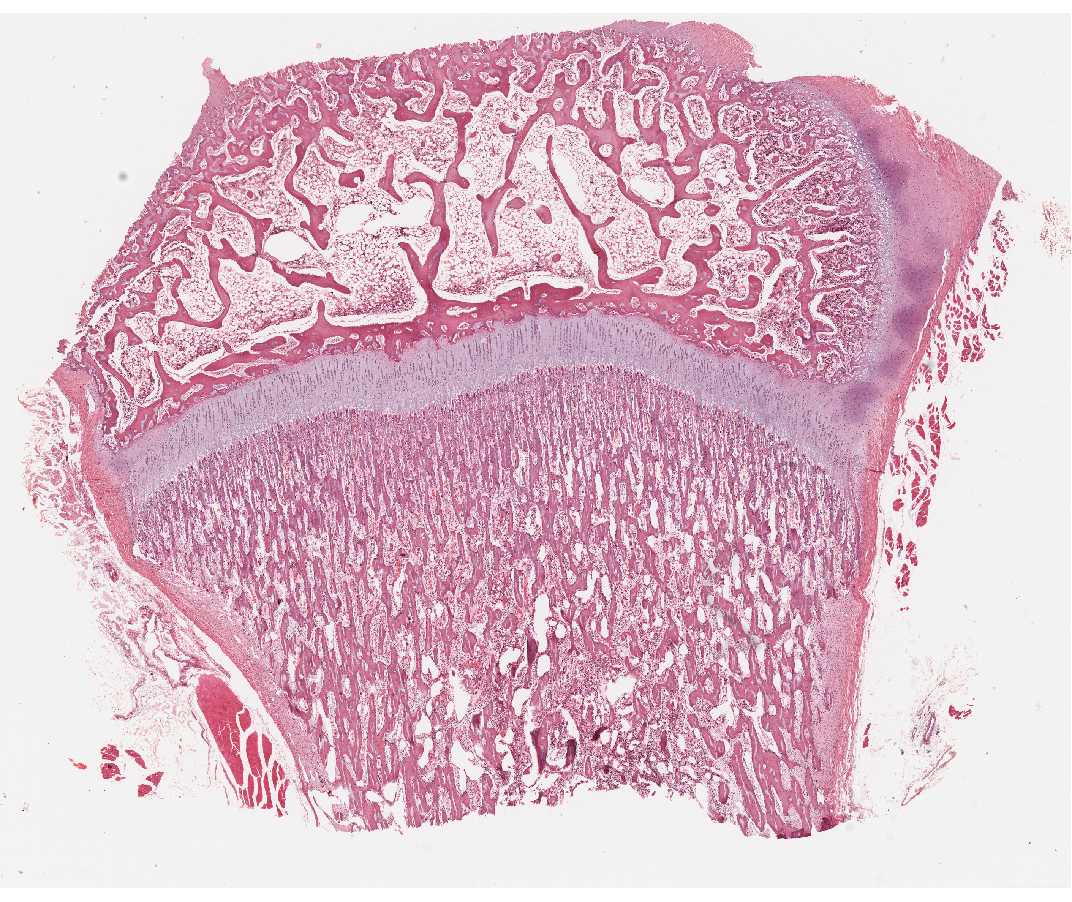 #96 Epiphyseal growth plate, H&E  