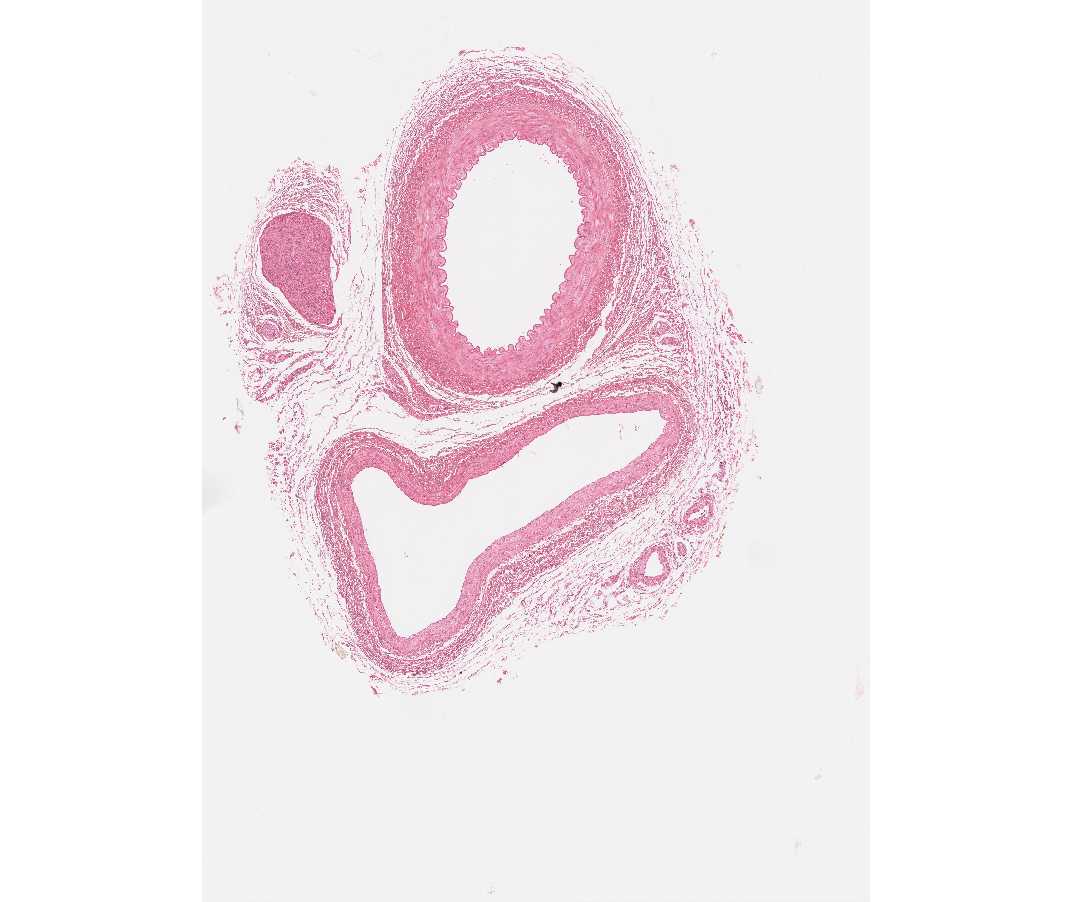 #113 Artery, vein and nerve H&E