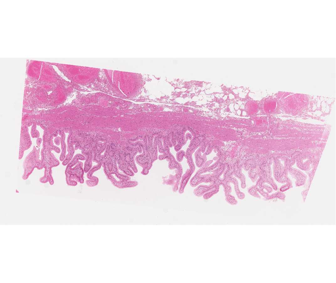 #115 Gall bladder, Human. H&E