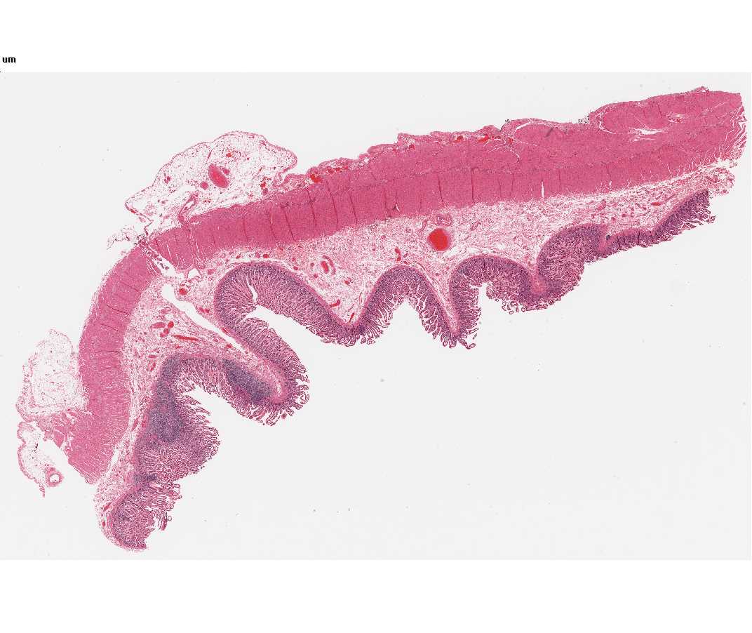 #117 Small intestine (H&E)