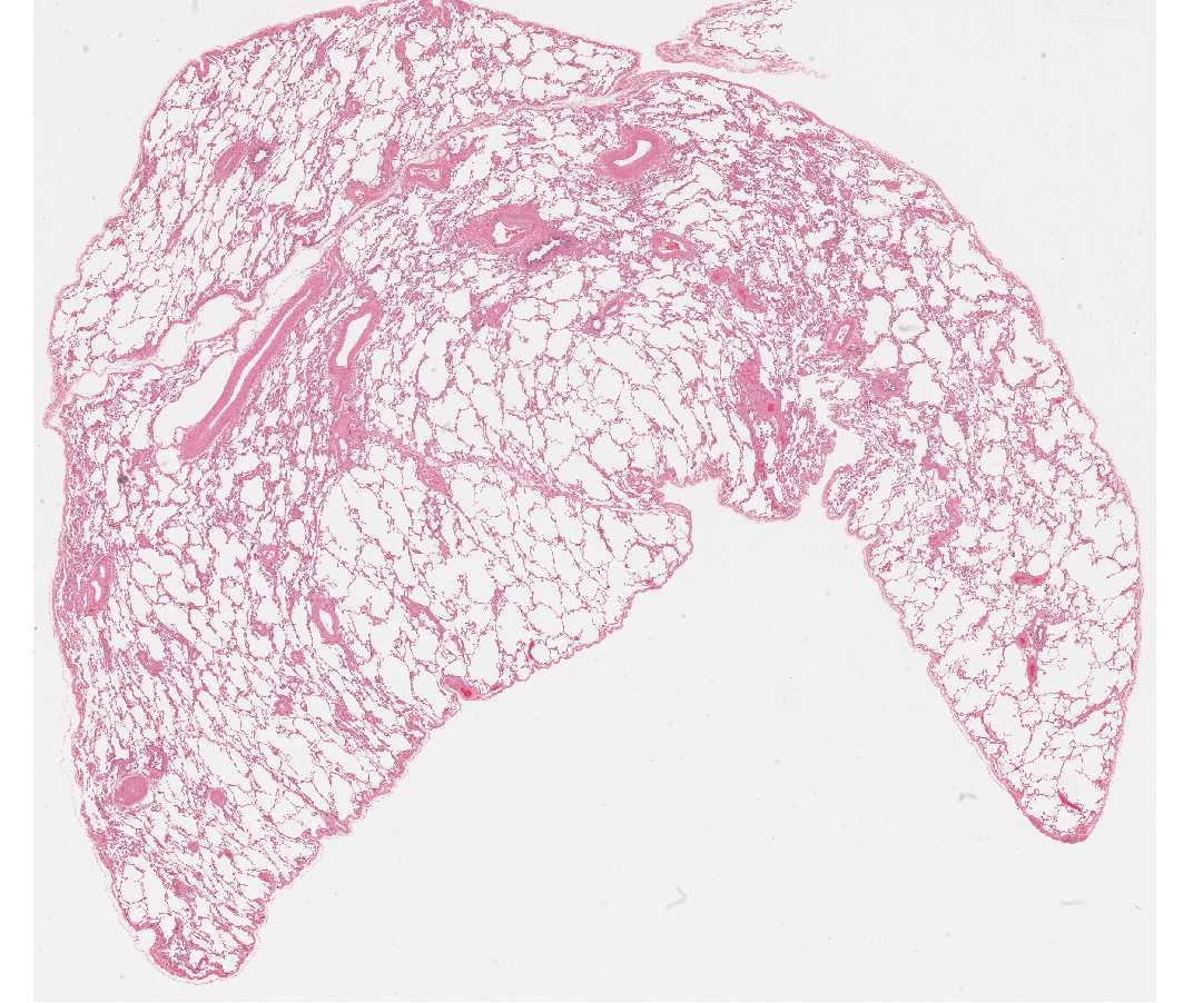 #118 Lung, Human H&E 